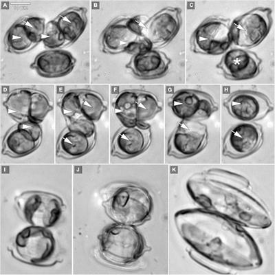 Life History of the Diatom Schizostauron trachyderma: Cell Size and Lipid Accumulation